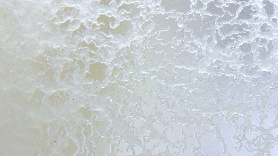 What Are Microworms? The Perfect Next Step in Feeding Growing Fish Fry